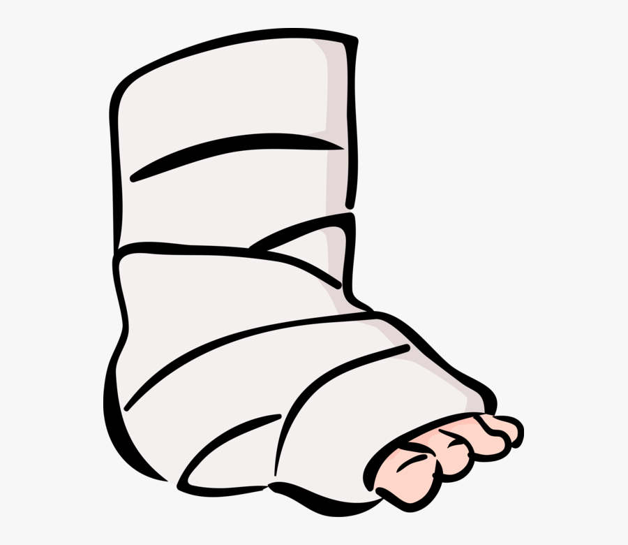 Accident Patient With Broken Ankle - Broken Leg Clipart Png, Transparent Clipart