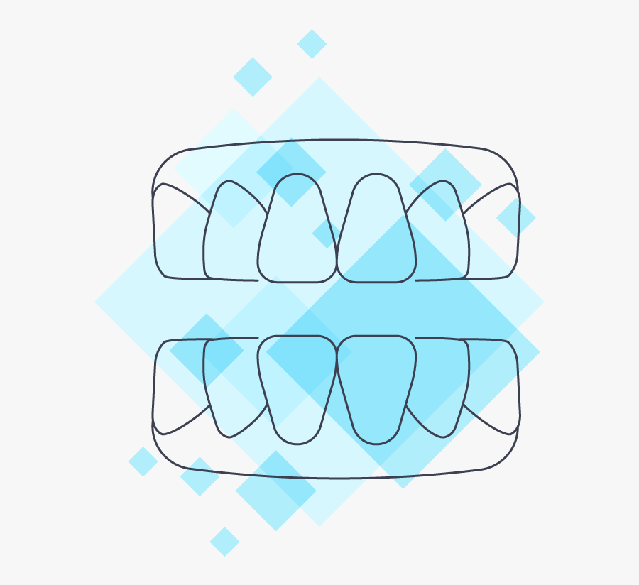 How Is A Dental Implant Done - Dental Implant, Transparent Clipart