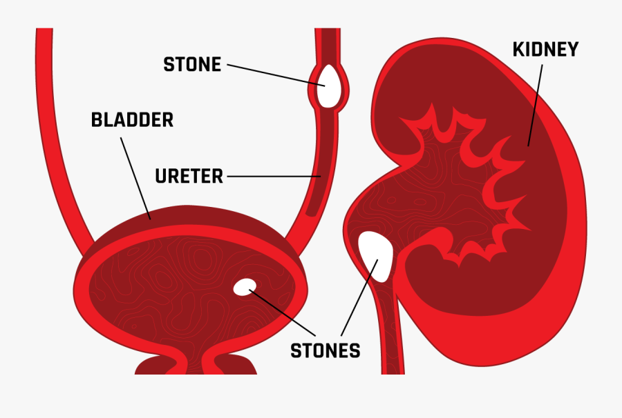 Clip Art Stones Overview Relief Illustration, Transparent Clipart