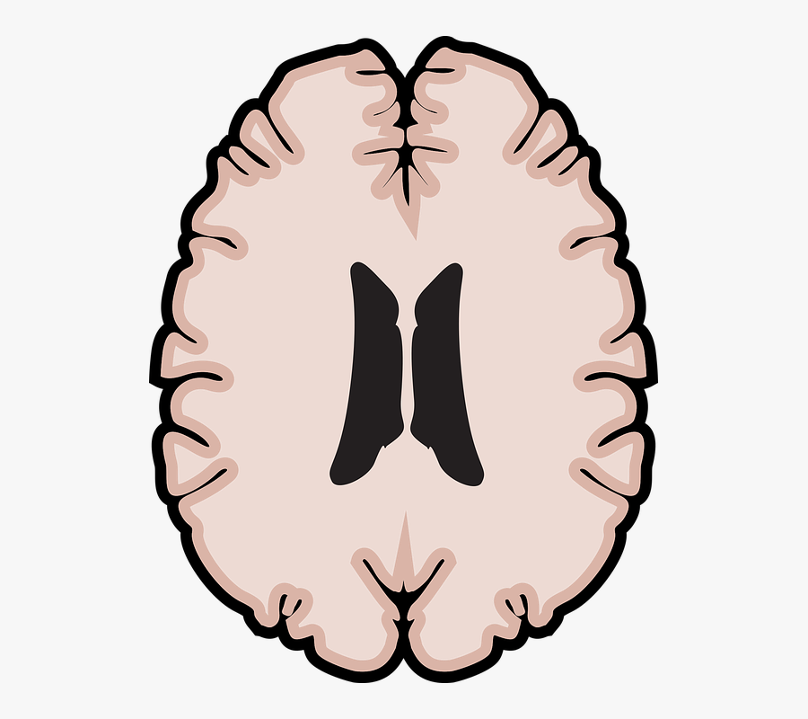 Brain Clipart , Png Download - Brain Scan Vector Free, Transparent Clipart