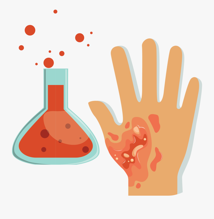 Chemical Burn Vector, Transparent Clipart