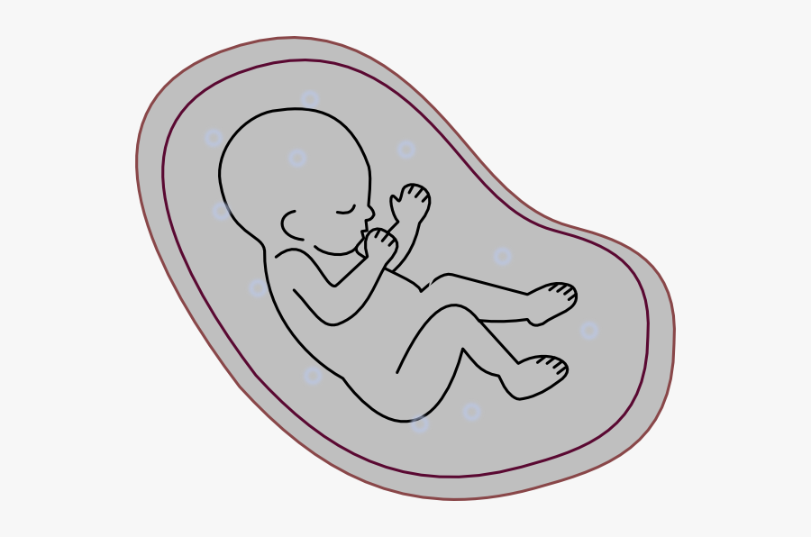 Intrauterine Growth Restriction Clipart, Transparent Clipart