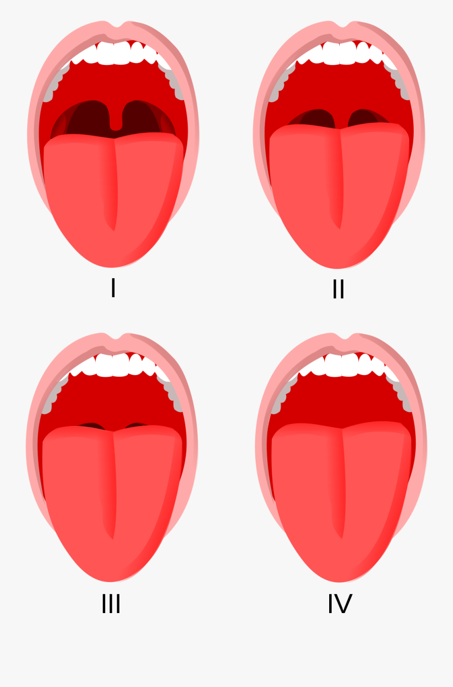 Φλεγμονη Στη Σταφυλή, Transparent Clipart