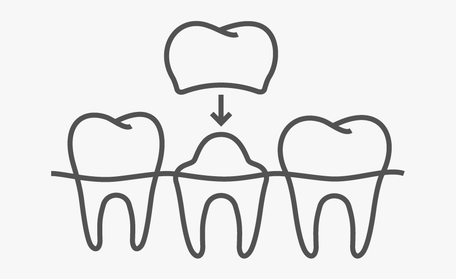 Crown And Bridges Icon, Transparent Clipart