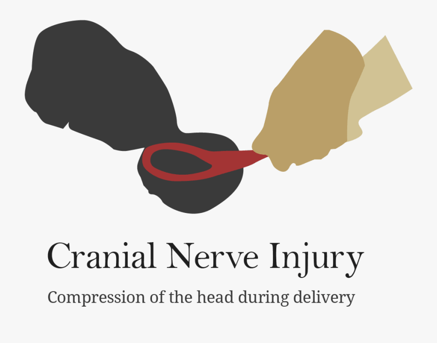 Illustration Of Forceps Being Used On Baby Tamil Kavithai About