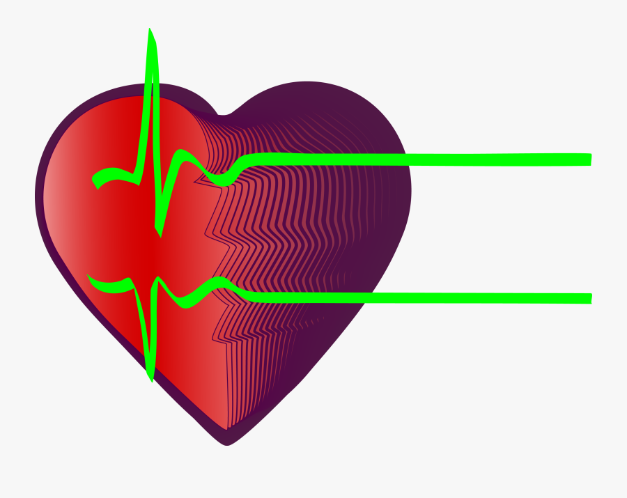 Electrocardiography Heart Rate Myocardial Infarction - Frecuencia Cardiaca Infarto De Miocardio, Transparent Clipart
