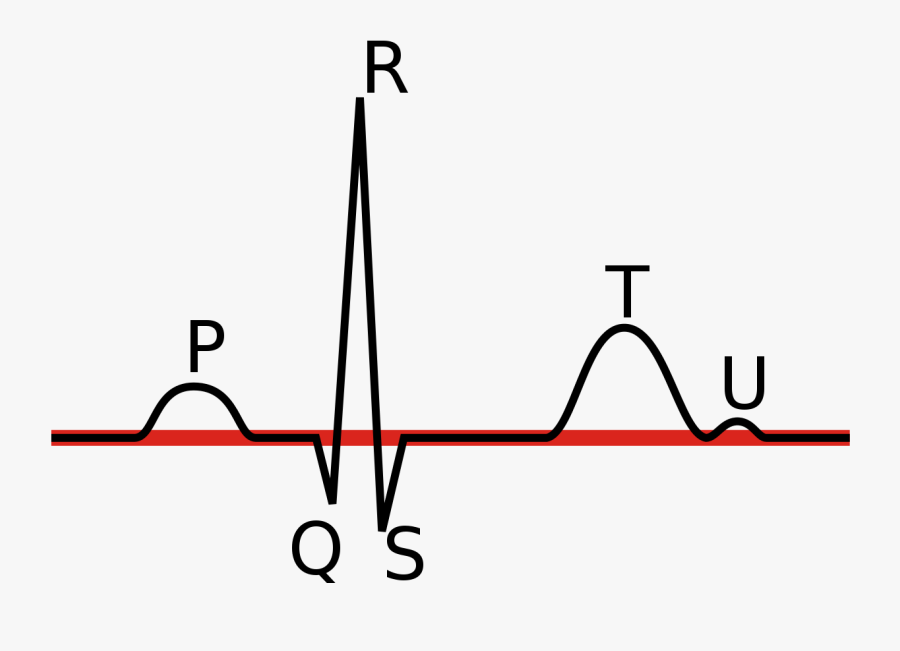 Linia Izoelektryczna Ekg - Linia Ekg, Transparent Clipart