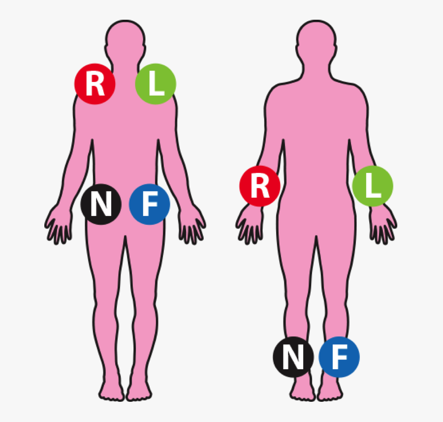 Image Transparent Stock Ekg Clipart Ems - Ecg Limb Leads Position, Transparent Clipart