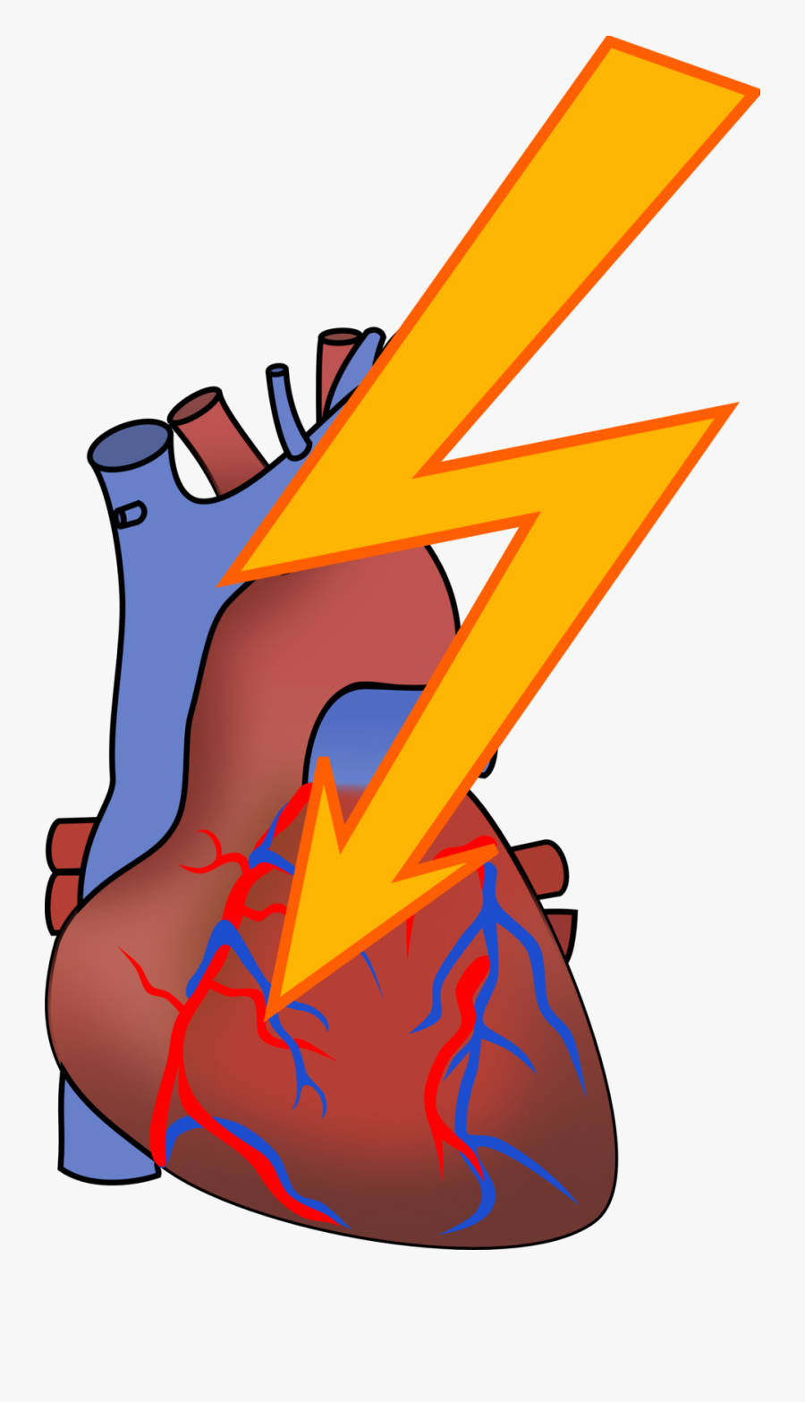 Attack Clipart - Heart Attack Clipart, Transparent Clipart