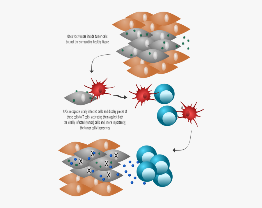 Oncolytic Virotherapy Immunology Explained, Transparent Clipart