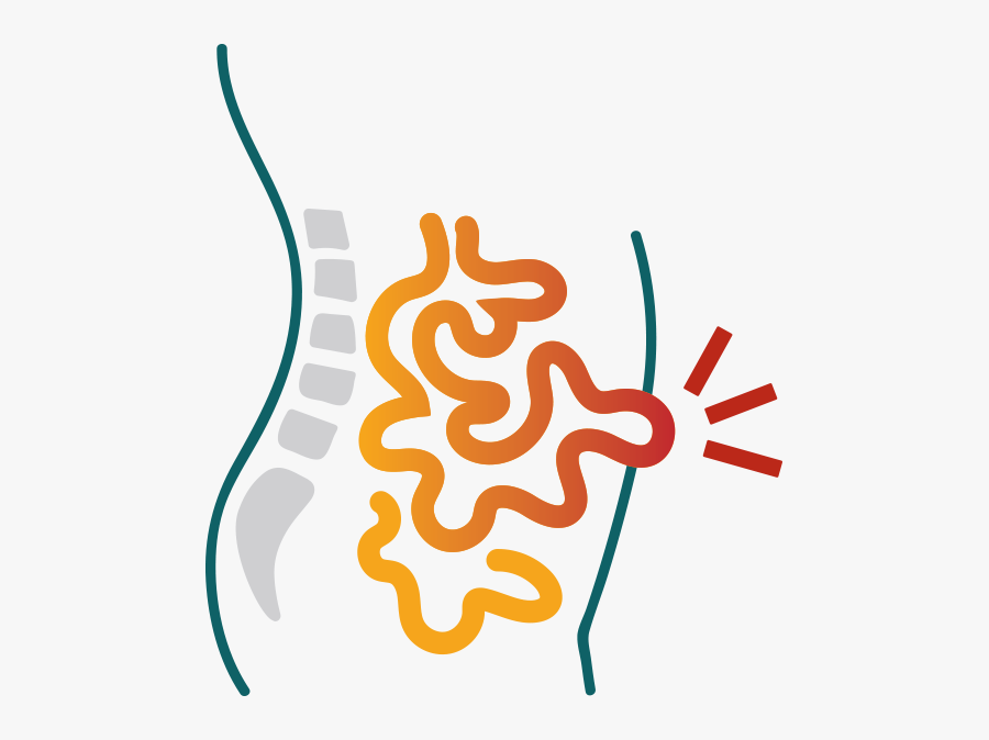 Hernia Information Symptoms, Transparent Clipart