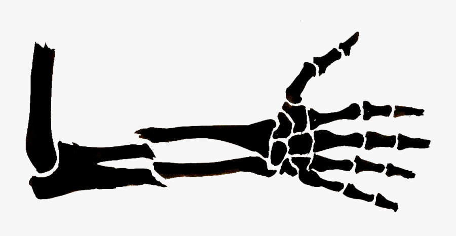 Pictures Of Broken Arm Free Download Clip Art Free - Drawing Of A Broken Arm, Transparent Clipart
