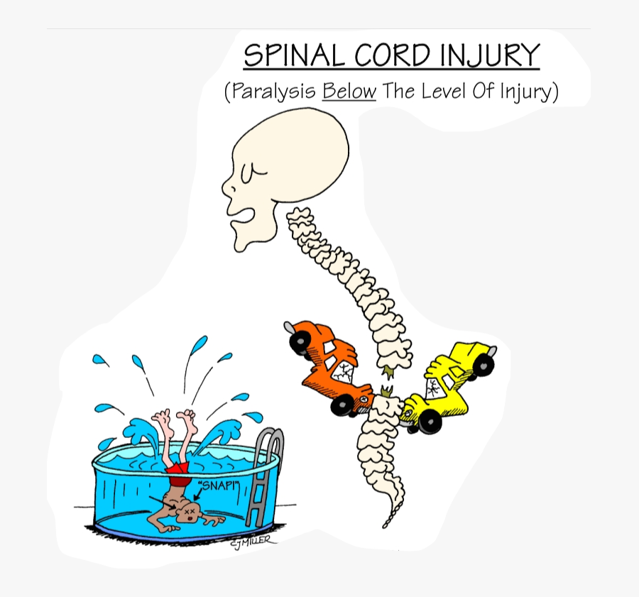 Mva Spinal Cord Injury, Transparent Clipart
