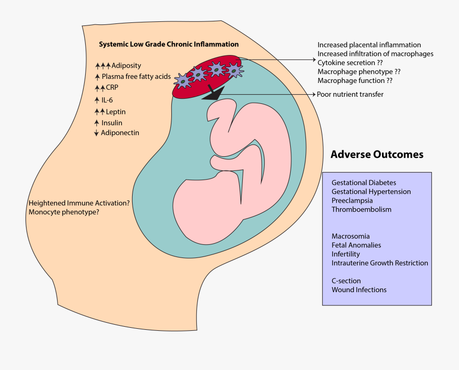 Diagram, Transparent Clipart