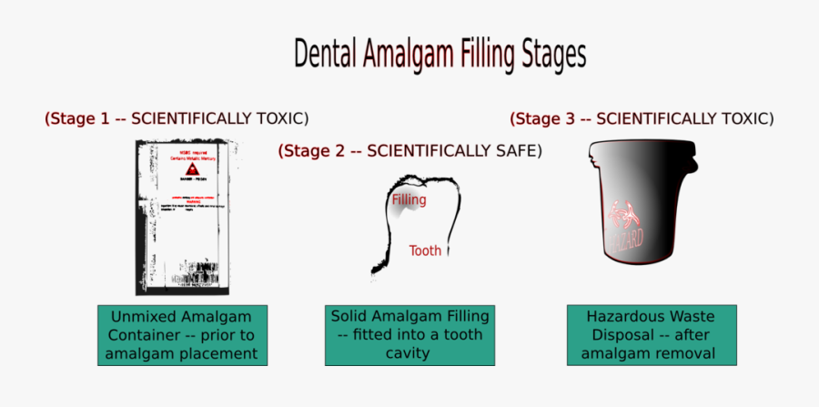 Stages Of Filling Dental Amalgam, Transparent Clipart