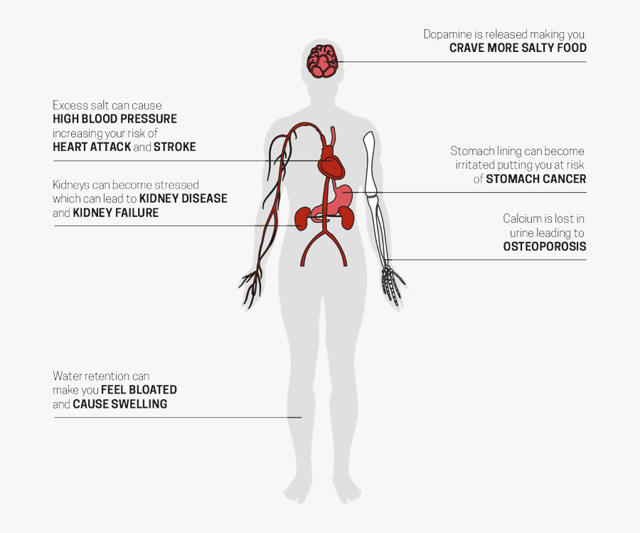 Transparent High Blood Pressure Clipart - Does Salt Help The Body, Transparent Clipart