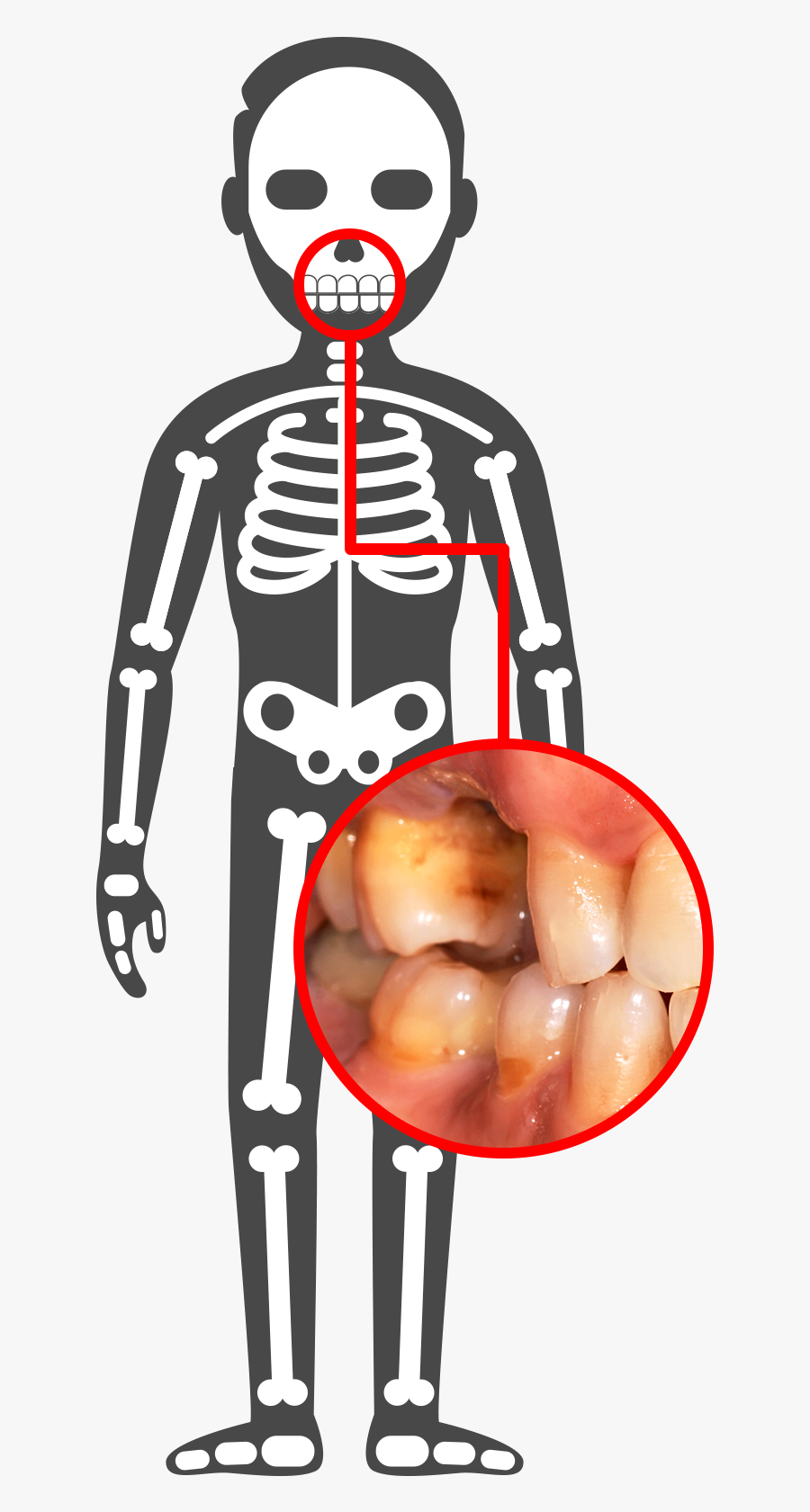 Html Css Js Skeleton, Transparent Clipart