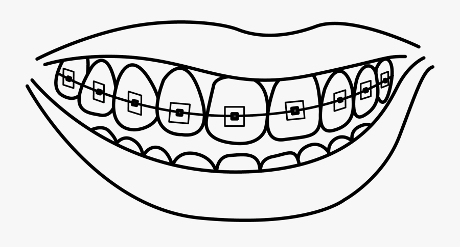 Collection Of With - Teeth With Braces Drawing, Transparent Clipart