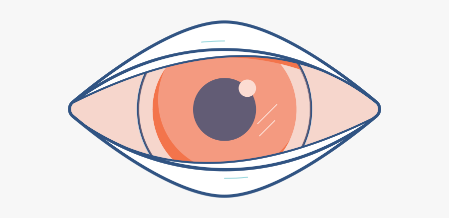 Pink Eyes Clipart Eye Disease - Clip Art Conjunctivitis Png, Transparent Clipart