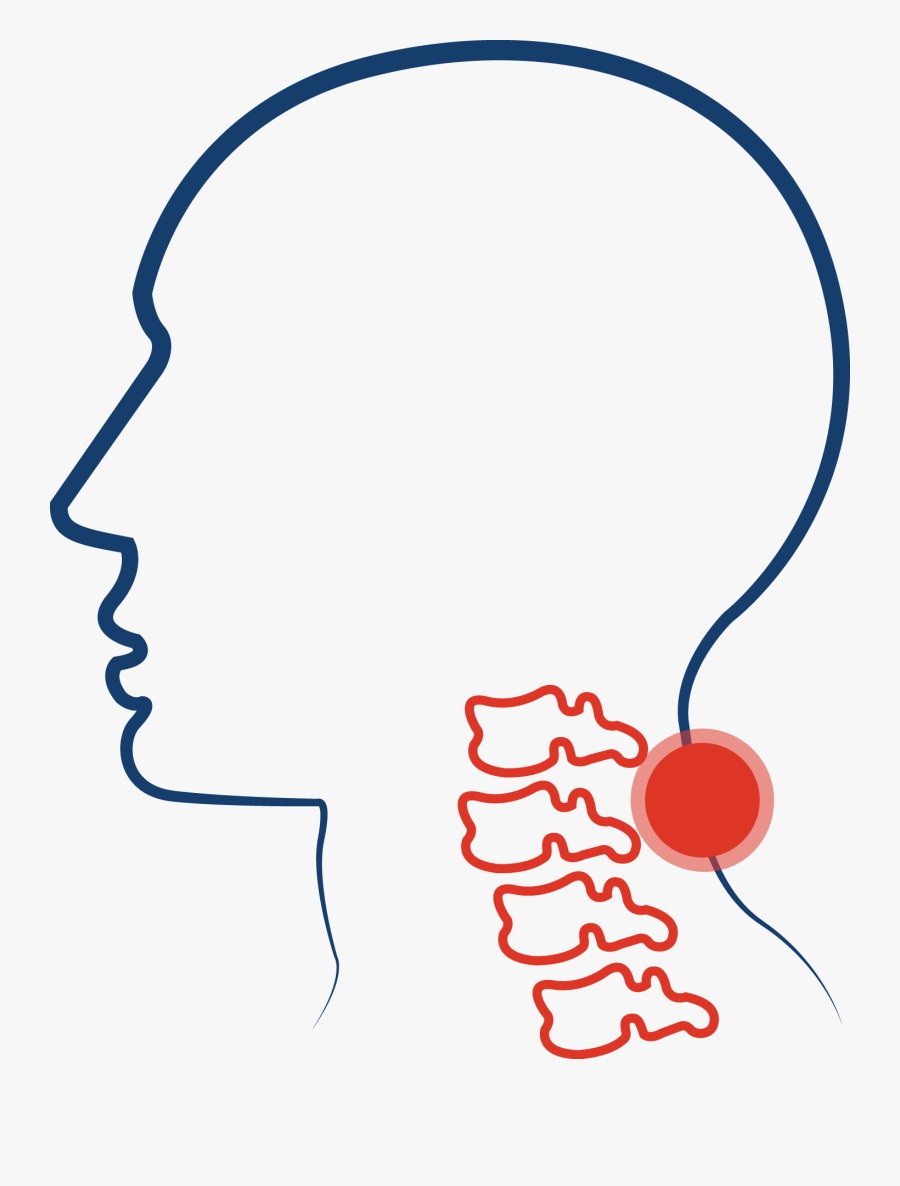 Cervical Spinal Stenosis Clipart , Png Download - Cervical Spine Clip Art, Transparent Clipart