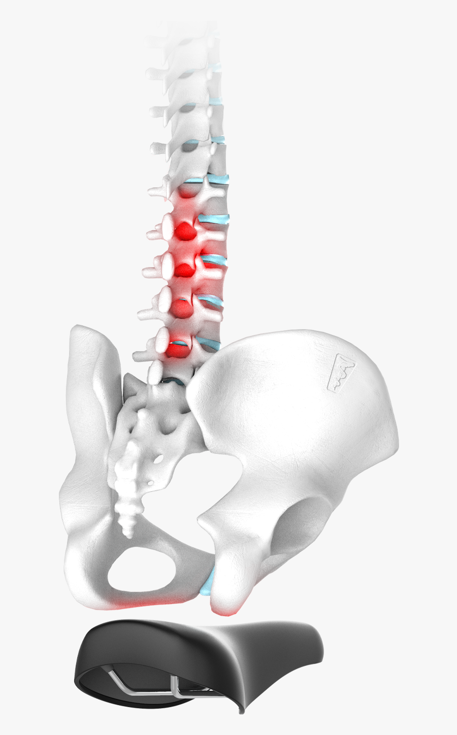 Spinal Disc Problems - X-ray, Transparent Clipart