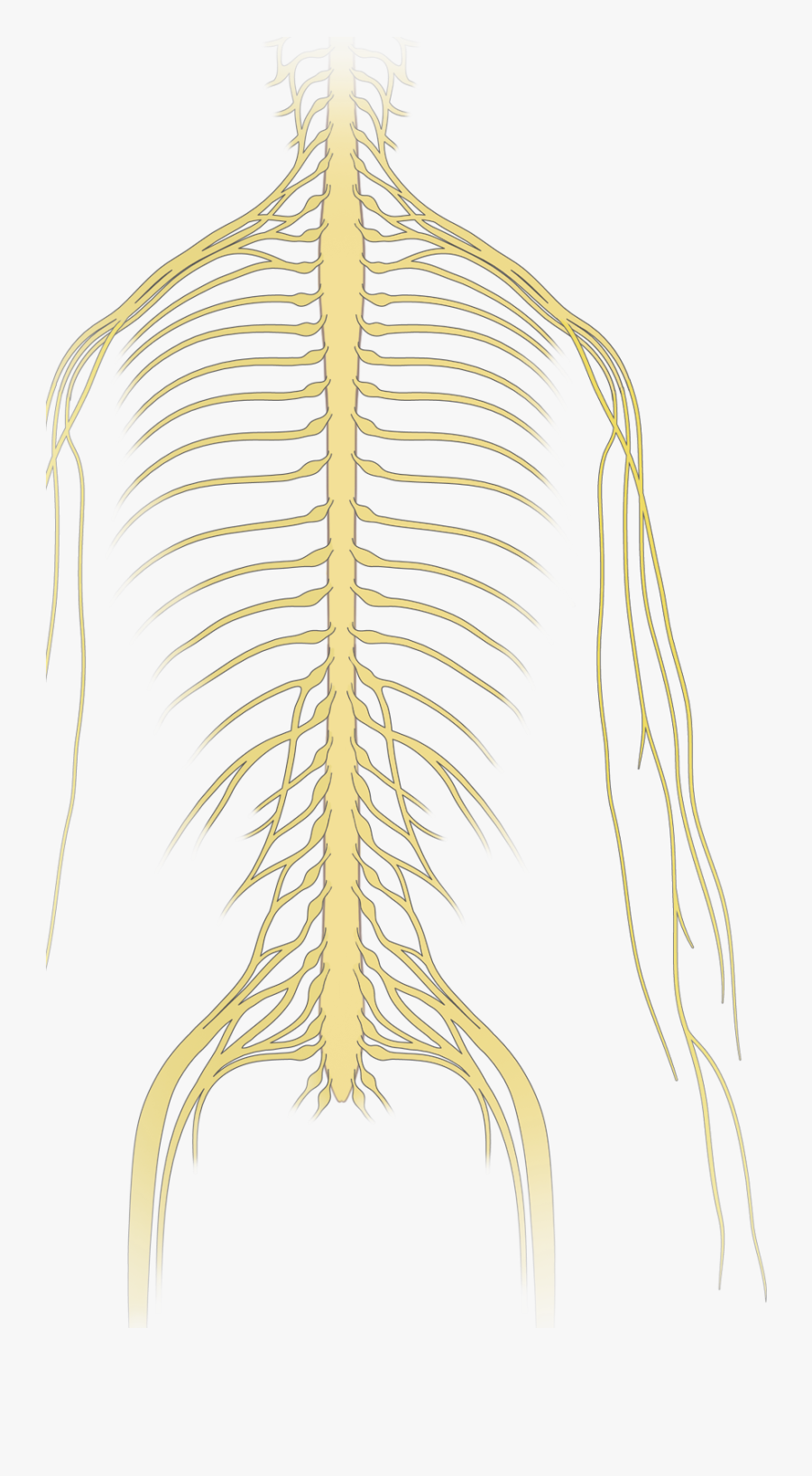 Neoplastic Epidural Spinal Cord Compression Nejm - Drawing, Transparent Clipart