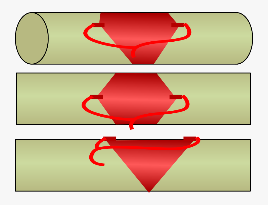 Free Clipart - &quot - Diamond&quot - Charge With C4 - Diamond Charge Explosive, Transparent Clipart