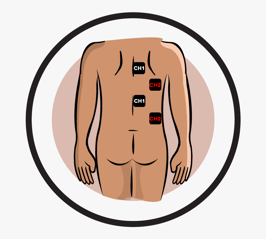 Electrode Pad Placement By - Transcutaneous Electrical Nerve Stimulation, Transparent Clipart