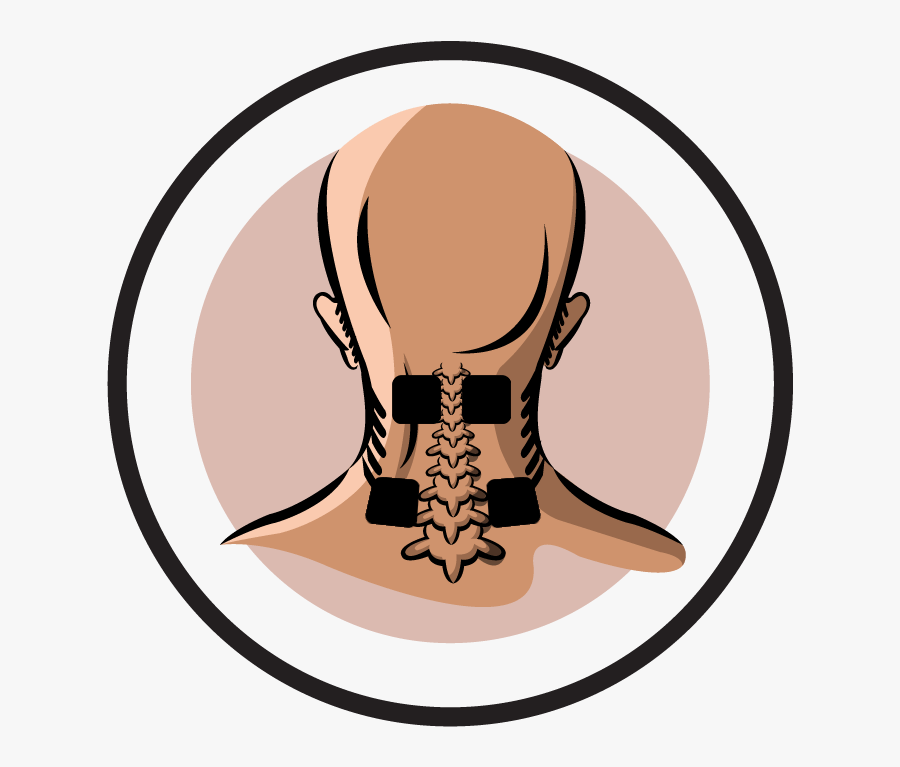 Electrode Pad Placement By Body Part Part - Tens Neck Pain Placement, Transparent Clipart