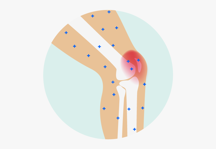 Pain Clipart Stiffness - Knee Pain Cartoon Png, Transparent Clipart