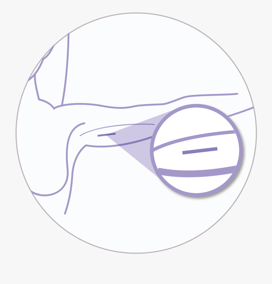 The Implant - Circle, Transparent Clipart