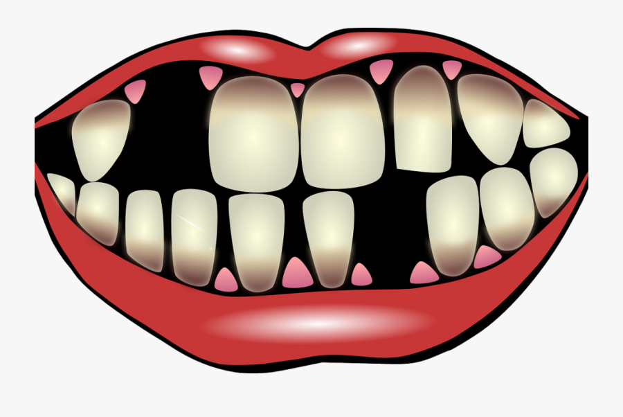 Teeth Clipart Gingivitis - Bad Teeth Png, Transparent Clipart
