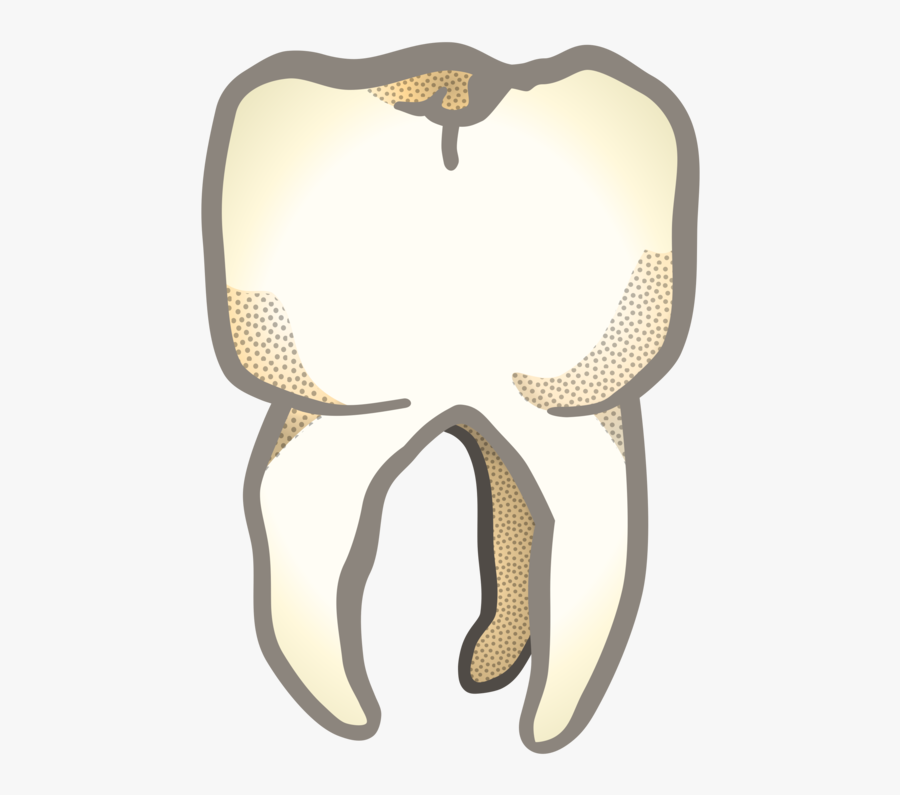 Jaw,organ,tooth - Tooth, Transparent Clipart