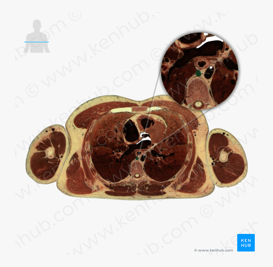 Azygos Vein - Transverse Section, Transparent Clipart