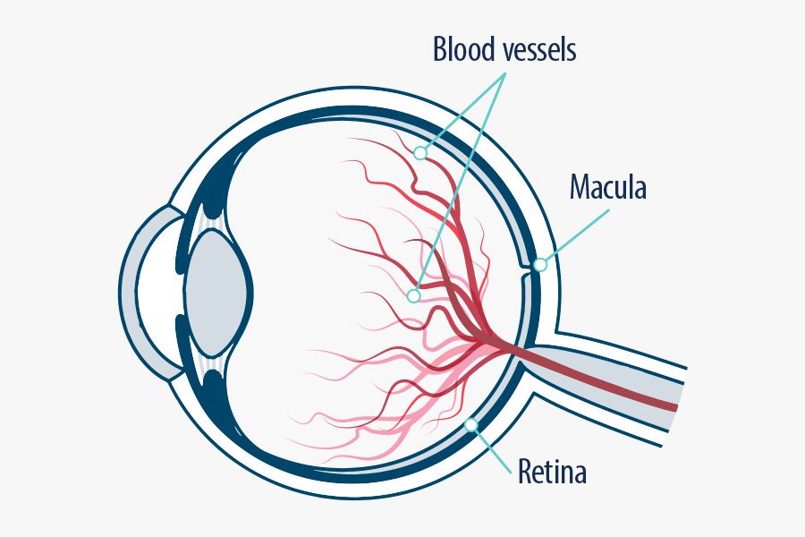 Medication Clipart Injection - Eye Retinal Blood Vessel, Transparent Clipart