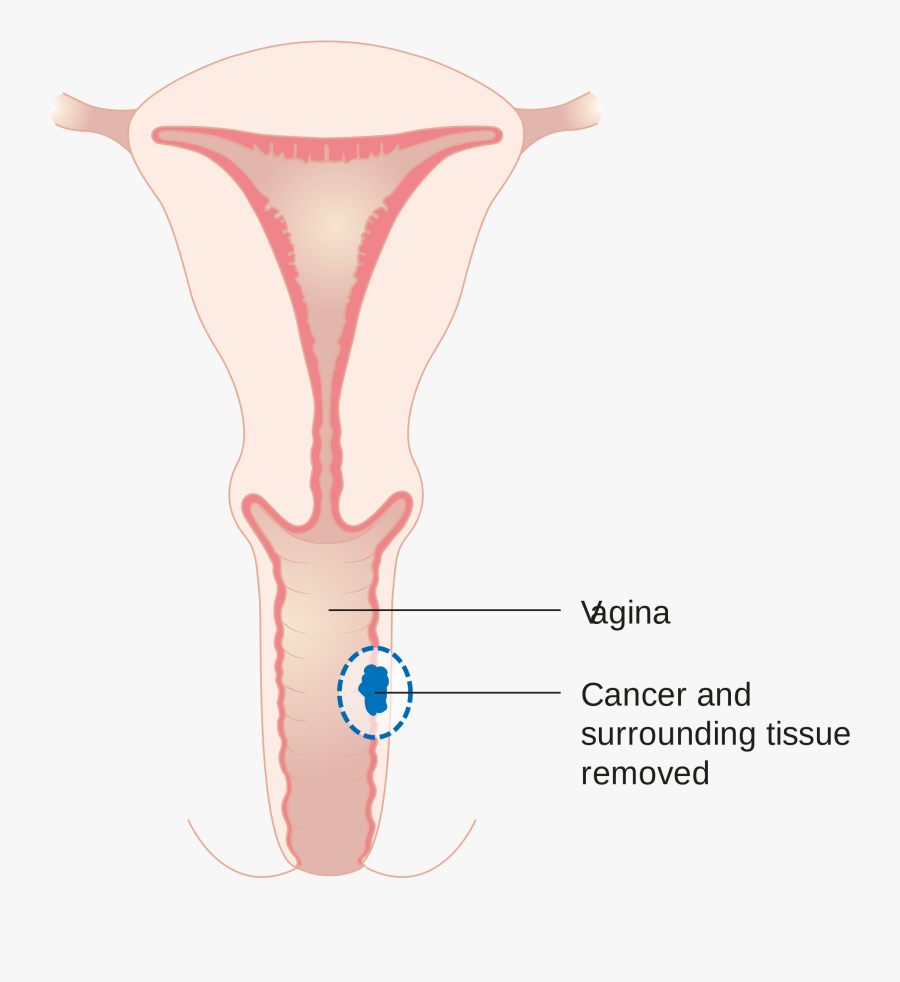 Vagina Clipart, Transparent Clipart