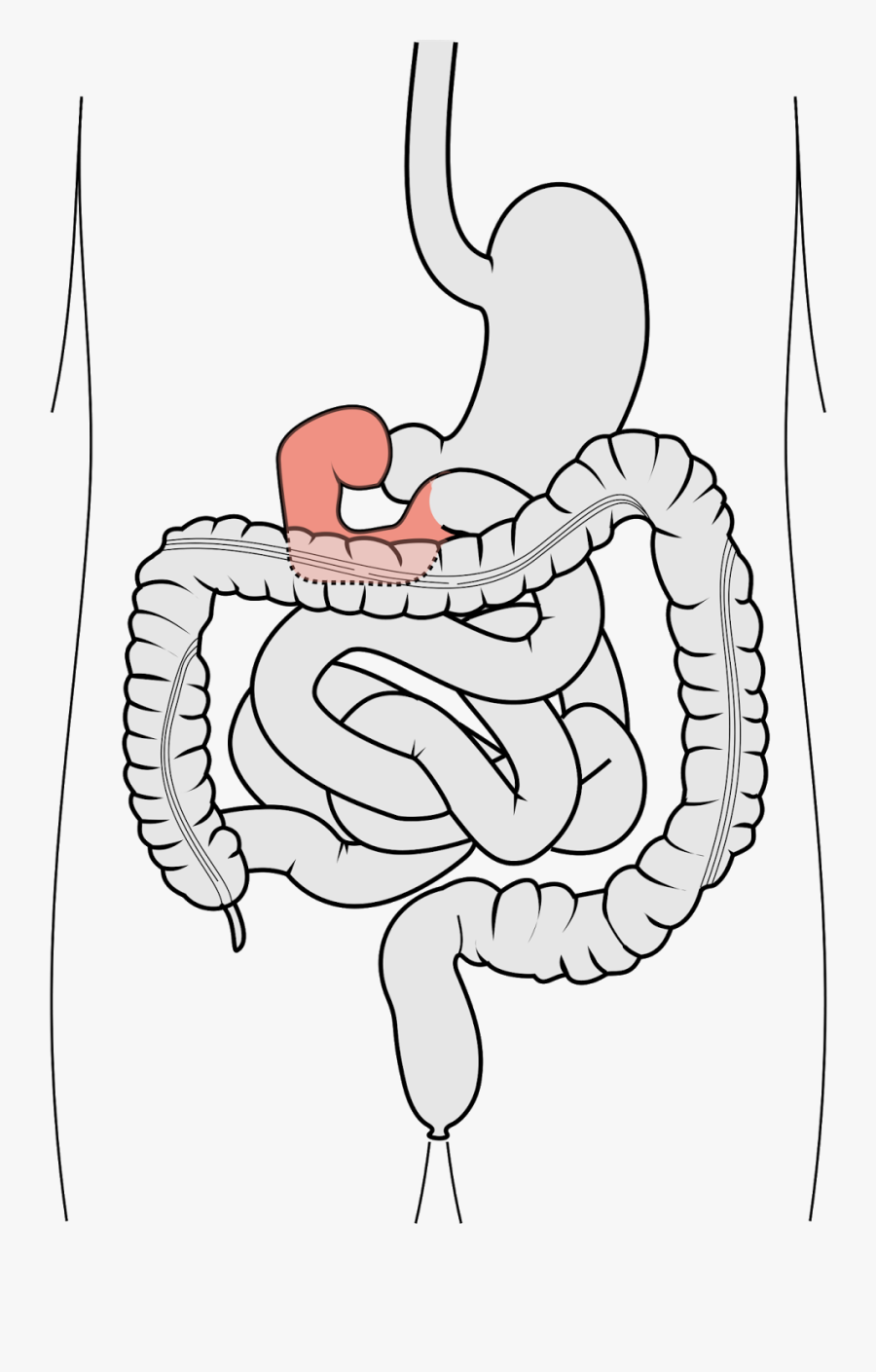 Duodenum - Duodenum Pain, Transparent Clipart