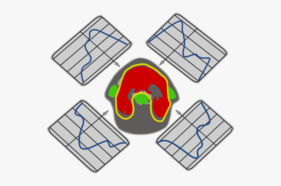 Mri - Clipart - Imrt Linac, Transparent Clipart