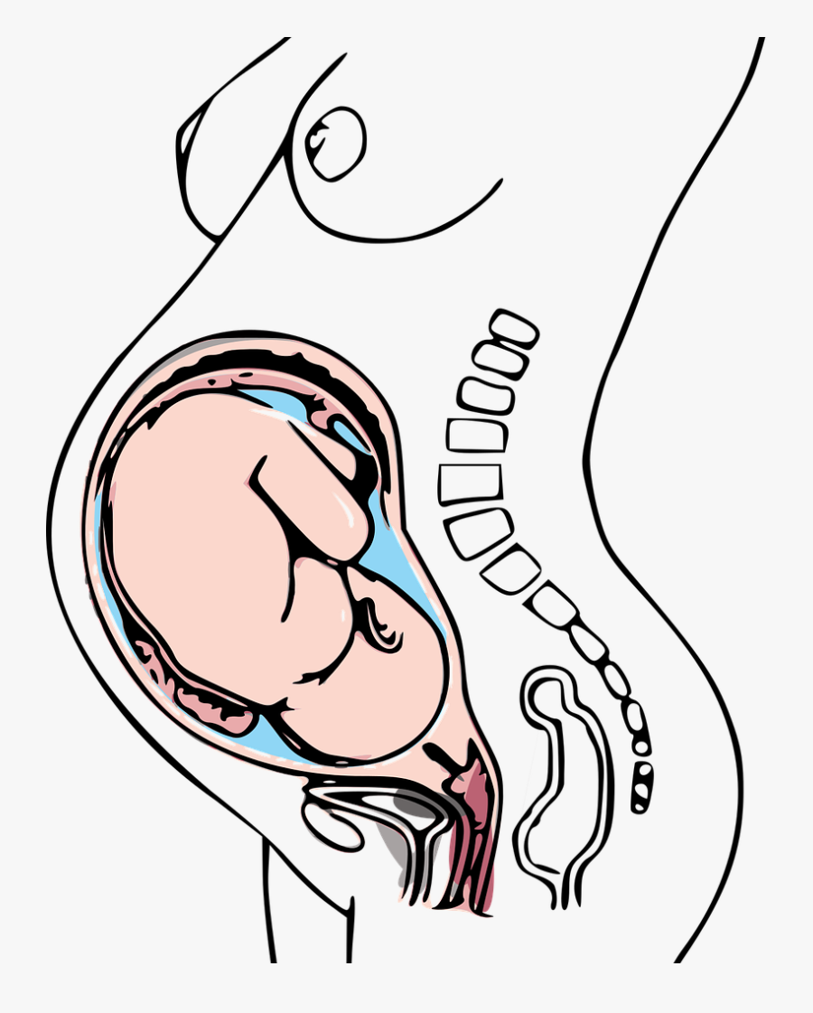 Low Dose Aspirin Can Help With Pregnancy, Transparent Clipart