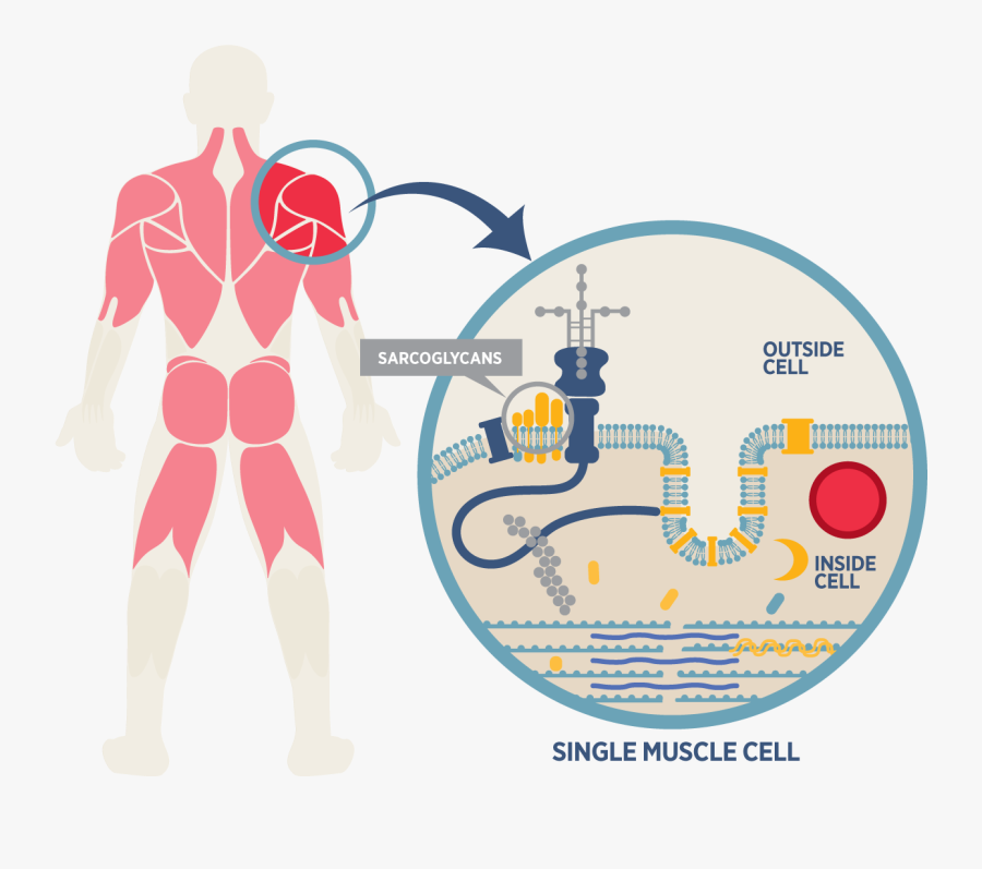 Kp Lgmd Infographic - Illustration, Transparent Clipart