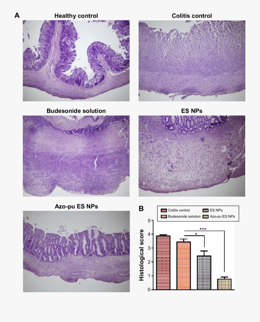 Histological Evaluation Of Colon Tissue From The Colitis - Colitis Small Intestine Rat, Transparent Clipart