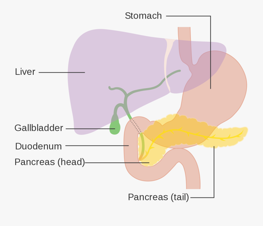Pancreatic Cancer Wikipedia - Hpb Cancer, Transparent Clipart