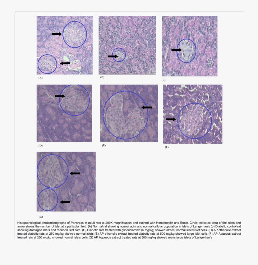 Histopathological Photomicrographs Of Pancreas - Circle, Transparent Clipart