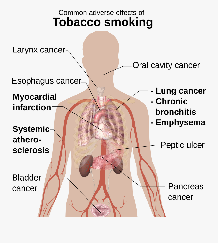 Common Adverse Effects Of Tobacco Smoking, Transparent Clipart