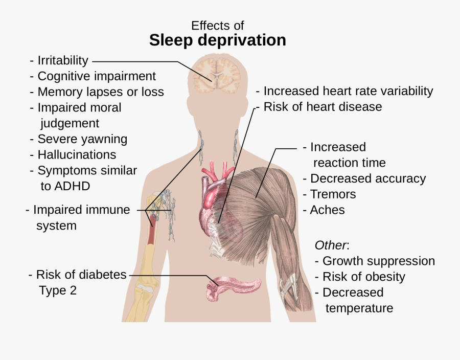 Почему ночью становится плохо. Последствия бессонницы. Причины плохого сна. Последствия нарушения сна. Причины расстройства сна.