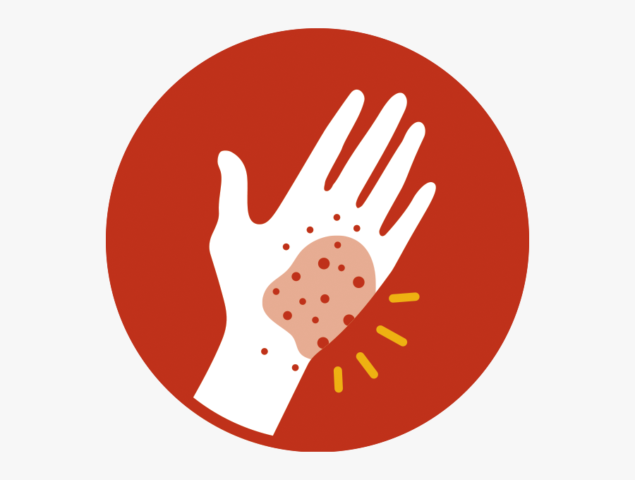 Transparent Skin Clipart - Skin Rash Png , Free Transparent Clipart