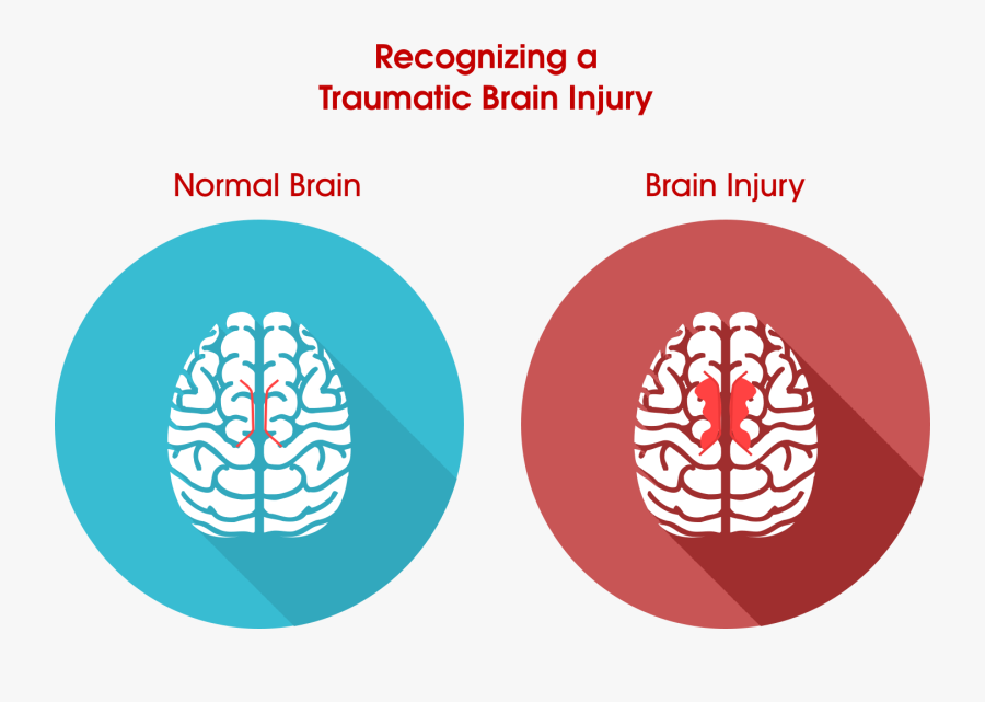 Brain Clipart Injury - Normal Brain Vs Injured Brain, Transparent Clipart
