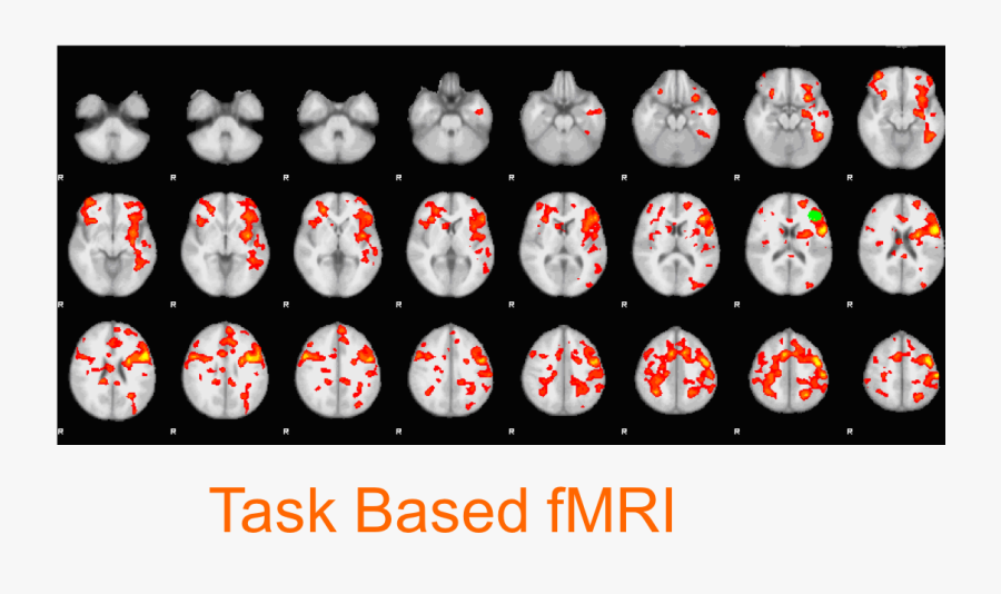 Research Image - Functional Mri, Transparent Clipart