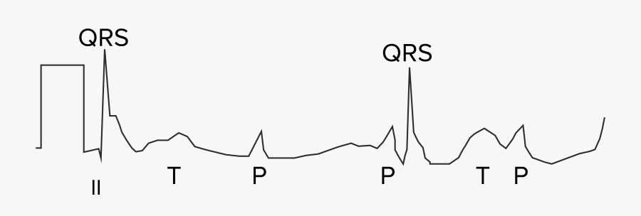 Transparent Ekg Png - Line Art, Transparent Clipart