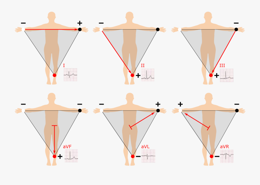Standard Limb Lead Ii, Transparent Clipart